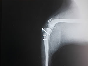 小型犬の膝蓋骨内方脱臼症の基本的な外科治療